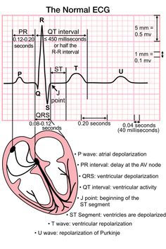 Electrocardiogram (ECG) - Vet-Cardio-Service UK